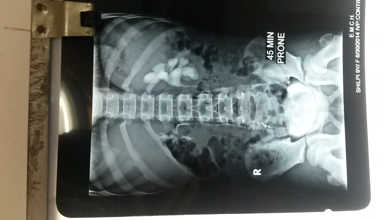 Pediatric Urology Image 5